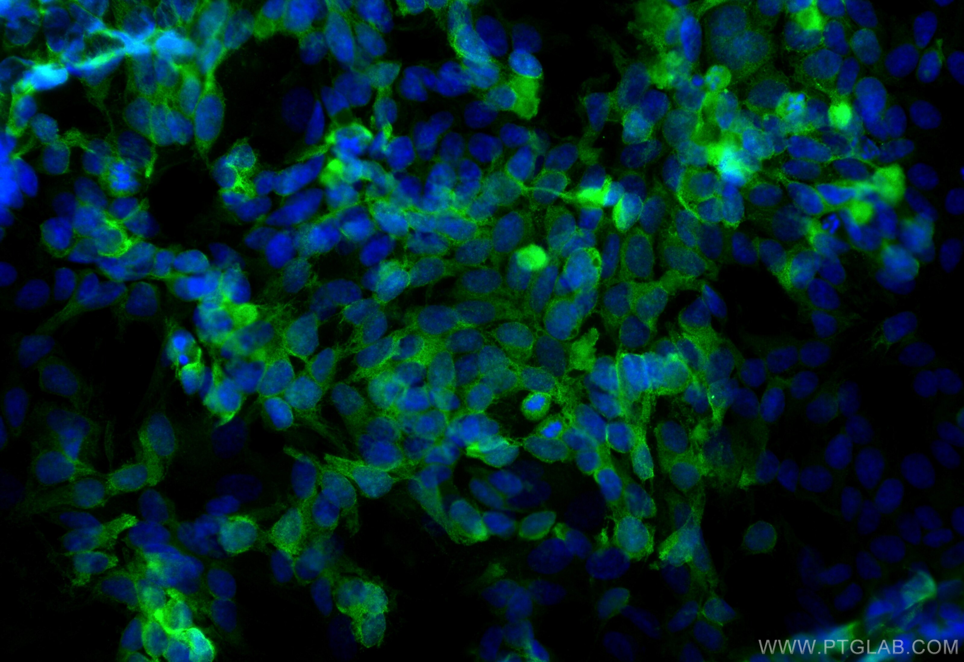 Immunofluorescence (IF) / fluorescent staining of SH-SY5Y cells using GPR150-Specific Polyclonal antibody (20213-1-AP)