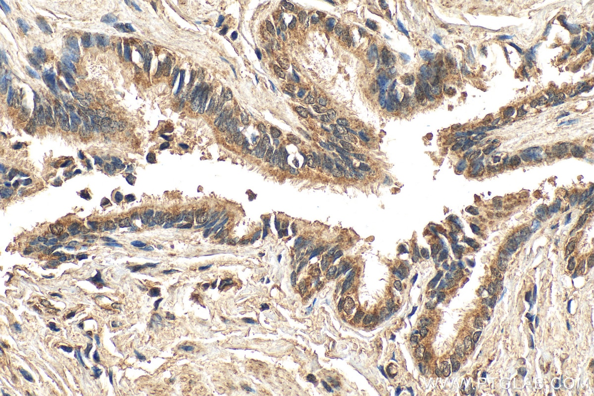 Immunohistochemistry (IHC) staining of human lung tissue using GPR151 Polyclonal antibody (30104-1-AP)