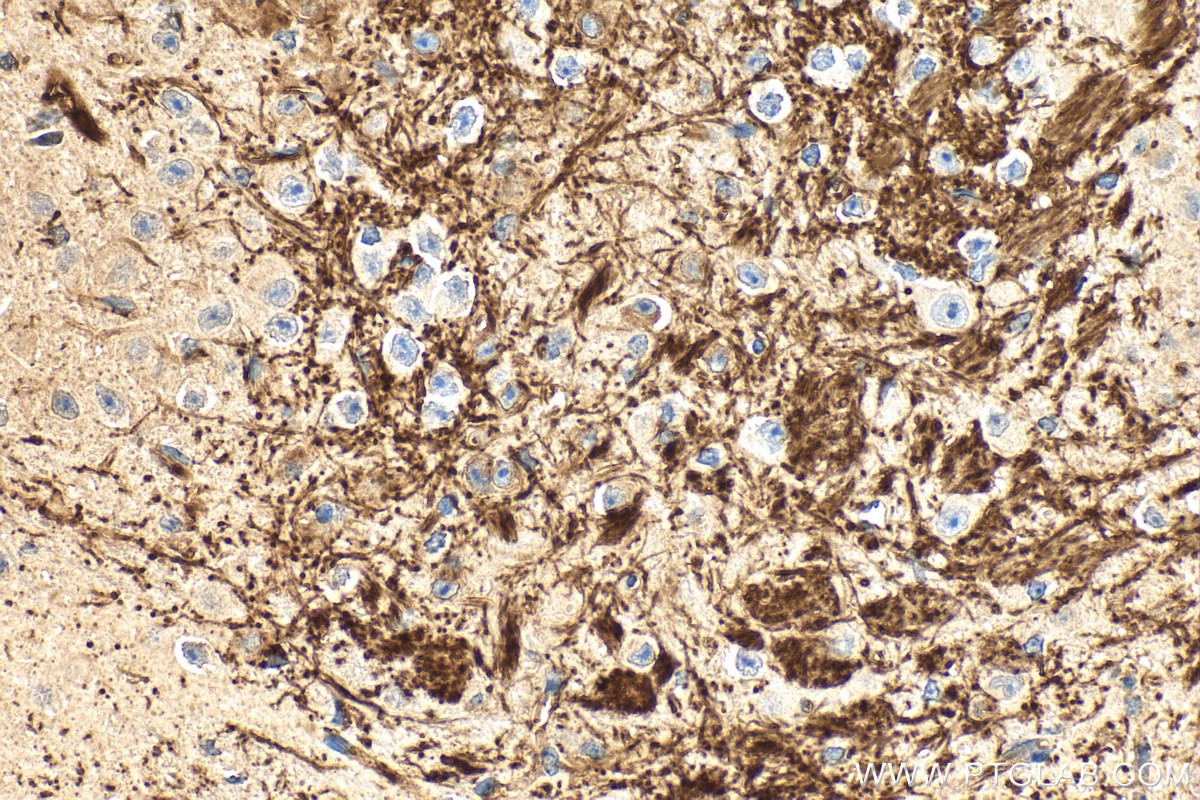 Immunohistochemistry (IHC) staining of mouse brain tissue using GPR151 Polyclonal antibody (30104-1-AP)