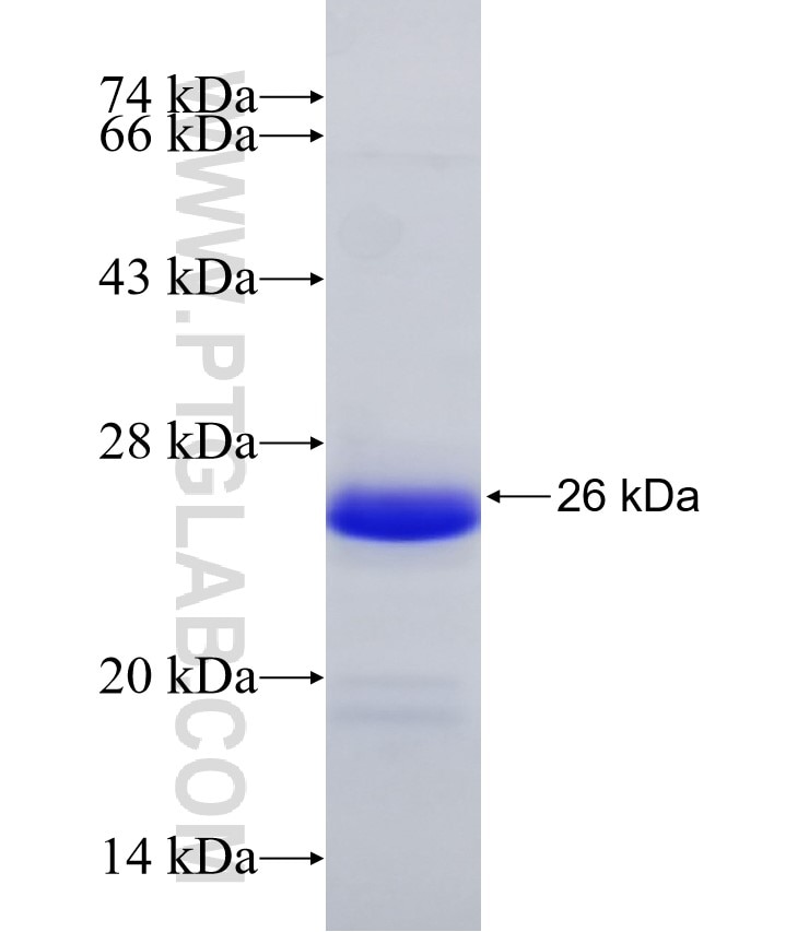 GPR151 fusion protein Ag32415 SDS-PAGE GPR151 fusion protein Ag32415 SDS-PAGE