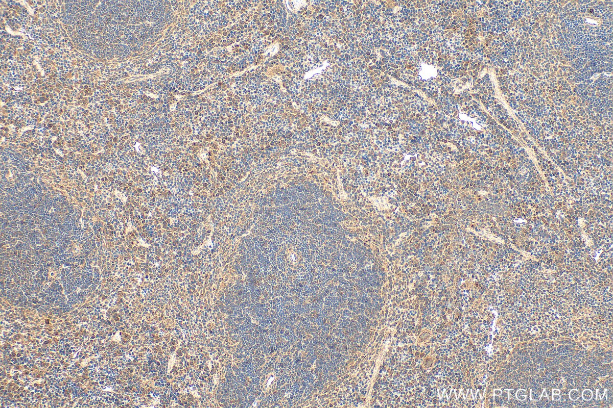 Immunohistochemistry (IHC) staining of mouse spleen tissue using GPR152 Polyclonal antibody (24391-1-AP)