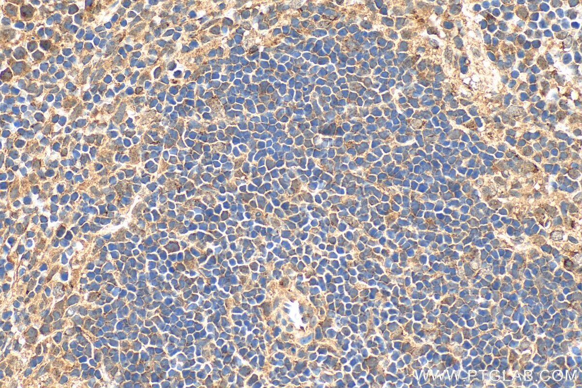 Immunohistochemistry (IHC) staining of mouse spleen tissue using GPR152 Polyclonal antibody (24391-1-AP)