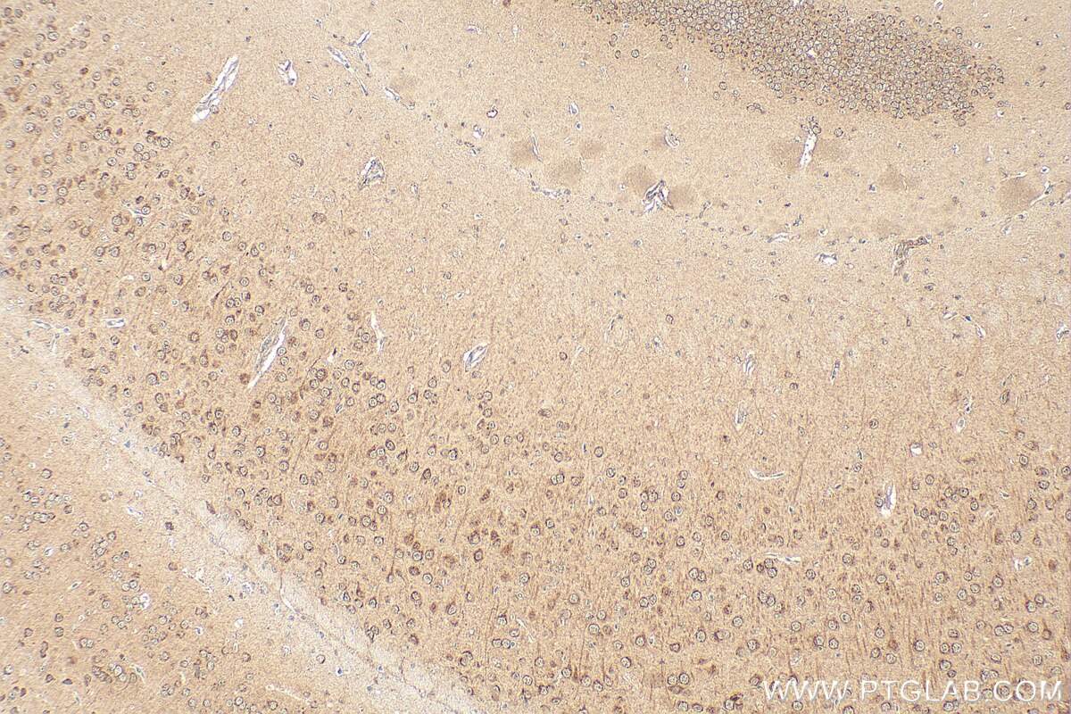 Immunohistochemistry (IHC) staining of mouse brain tissue using GPR152 Polyclonal antibody (24391-1-AP)