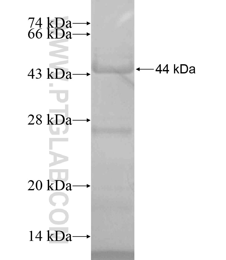 GPR152 fusion protein Ag18420 SDS-PAGE