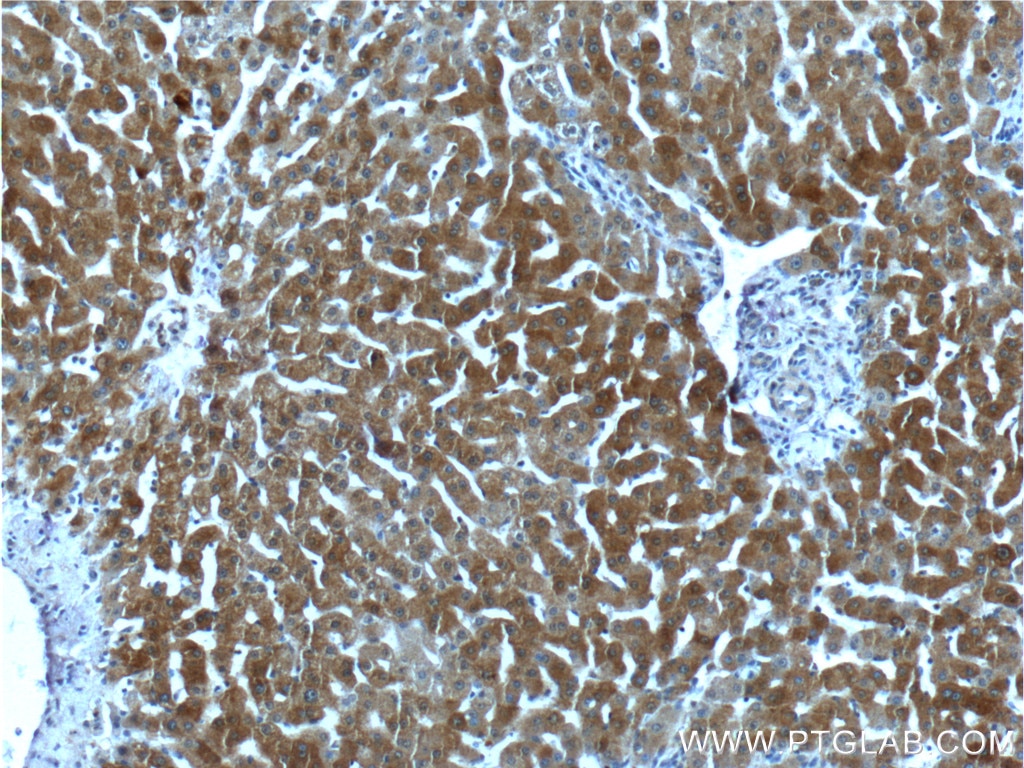 Immunohistochemistry (IHC) staining of human liver tissue using GPR153 Polyclonal antibody (24878-1-AP)