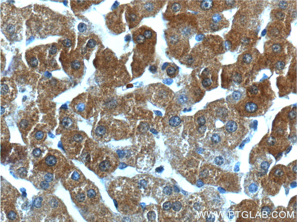 Immunohistochemistry (IHC) staining of human liver tissue using GPR153 Polyclonal antibody (24878-1-AP)