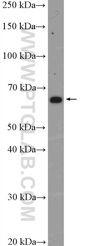 Western Blot (WB) analysis of Jurkat cells using GPR153 Polyclonal antibody (24878-1-AP)