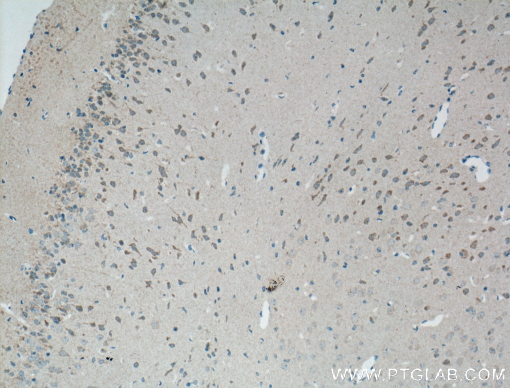 Immunohistochemistry (IHC) staining of mouse brain tissue using GPR155 Polyclonal antibody (12659-1-AP)