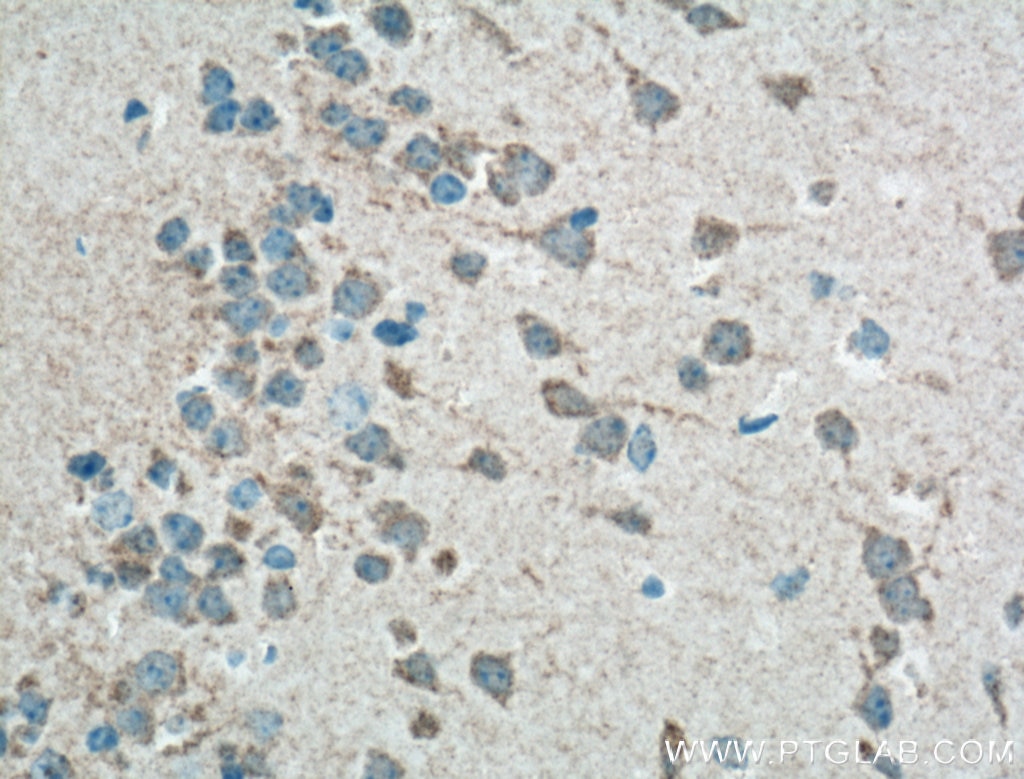 Immunohistochemistry (IHC) staining of mouse brain tissue using GPR155 Polyclonal antibody (12659-1-AP)