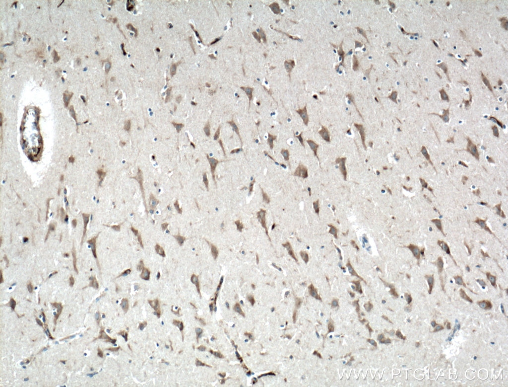 IHC staining of human brain using 12659-1-AP