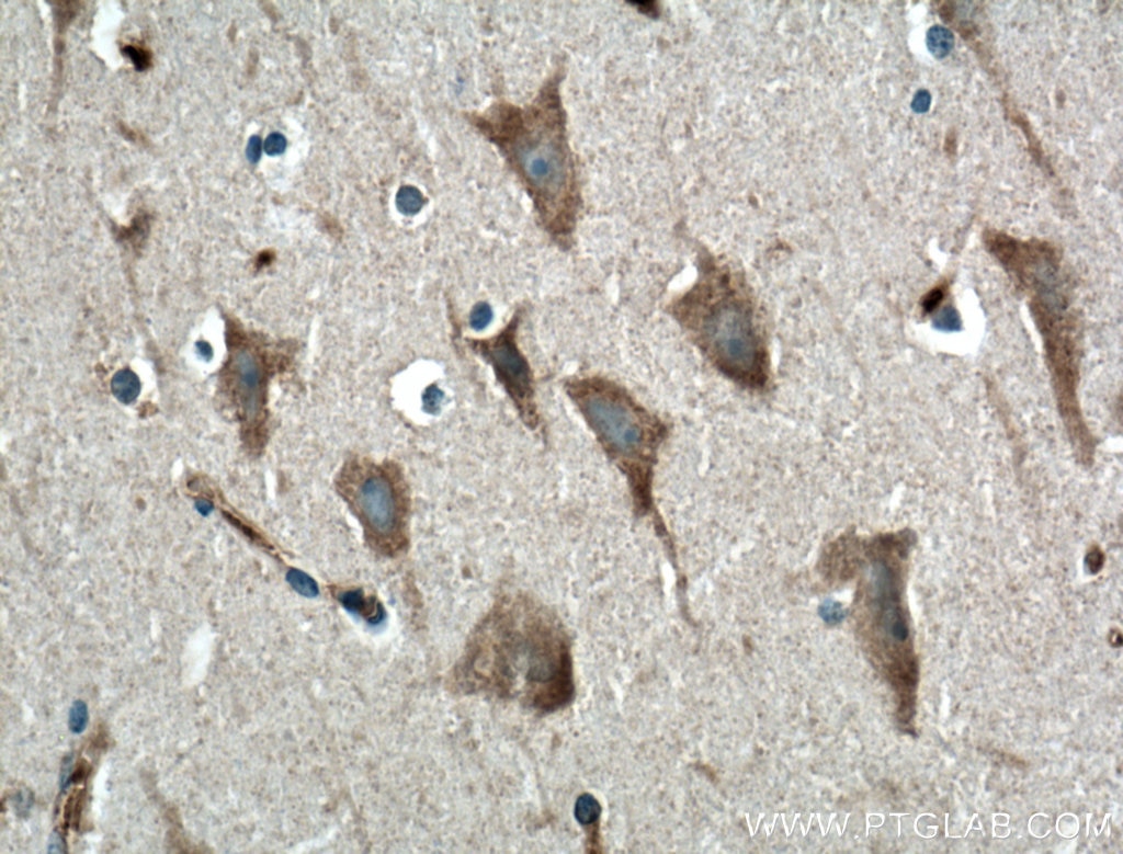 Immunohistochemistry (IHC) staining of human brain tissue using GPR155 Polyclonal antibody (12659-1-AP)