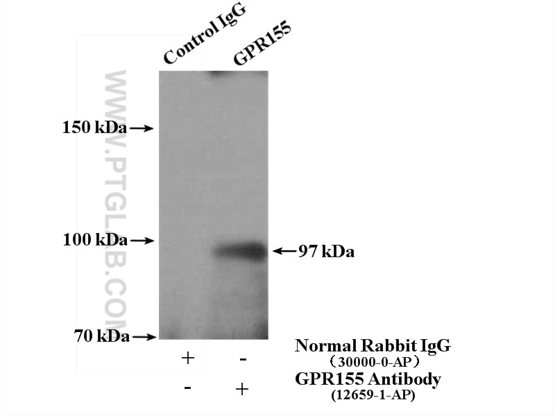 Immunoprecipitation (IP) experiment of mouse brain tissue using GPR155 Polyclonal antibody (12659-1-AP)