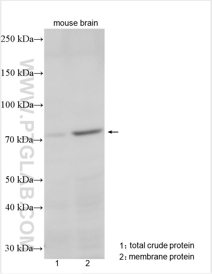 Western Blot (WB) analysis of various lysates using GPR155 Polyclonal antibody (12659-1-AP)