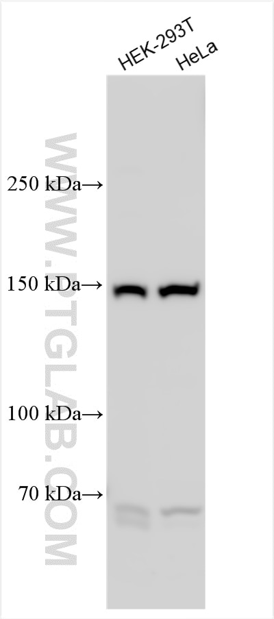 Western Blot (WB) analysis of various lysates using GPR158 Polyclonal antibody (31846-1-AP)