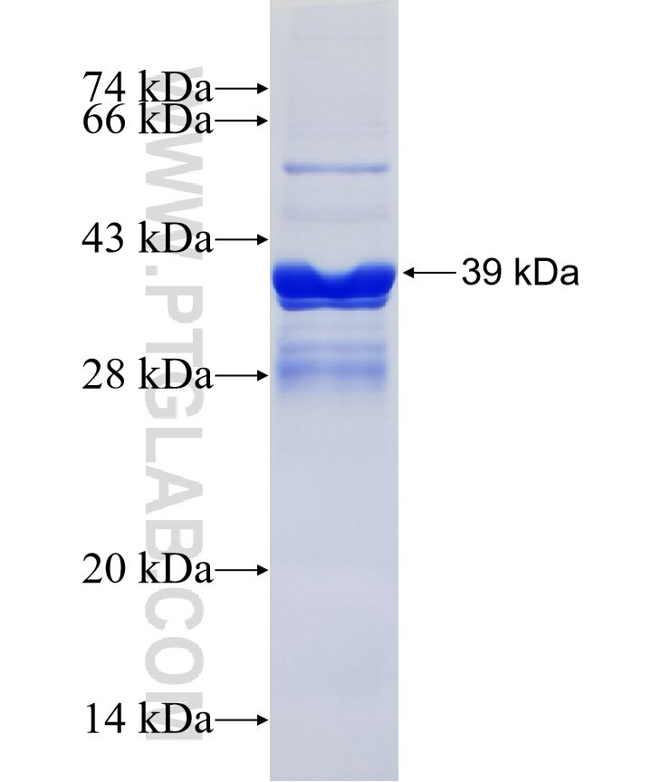 GPR160 fusion protein Ag14661 SDS-PAGE