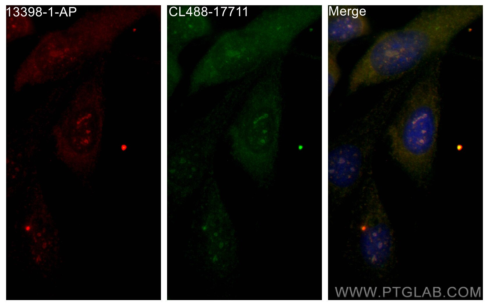 Immunofluorescence (IF) / fluorescent staining of MDCK cells using GPR161 Polyclonal antibody (13398-1-AP)