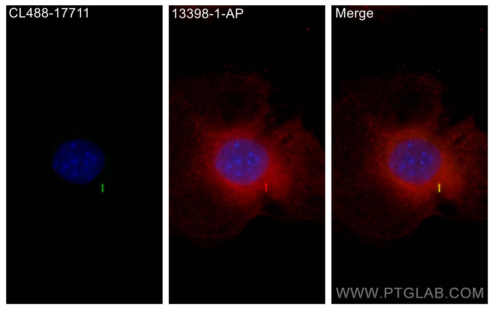 Immunofluorescence (IF) / fluorescent staining of C2C12 cells using GPR161 Polyclonal antibody (13398-1-AP)