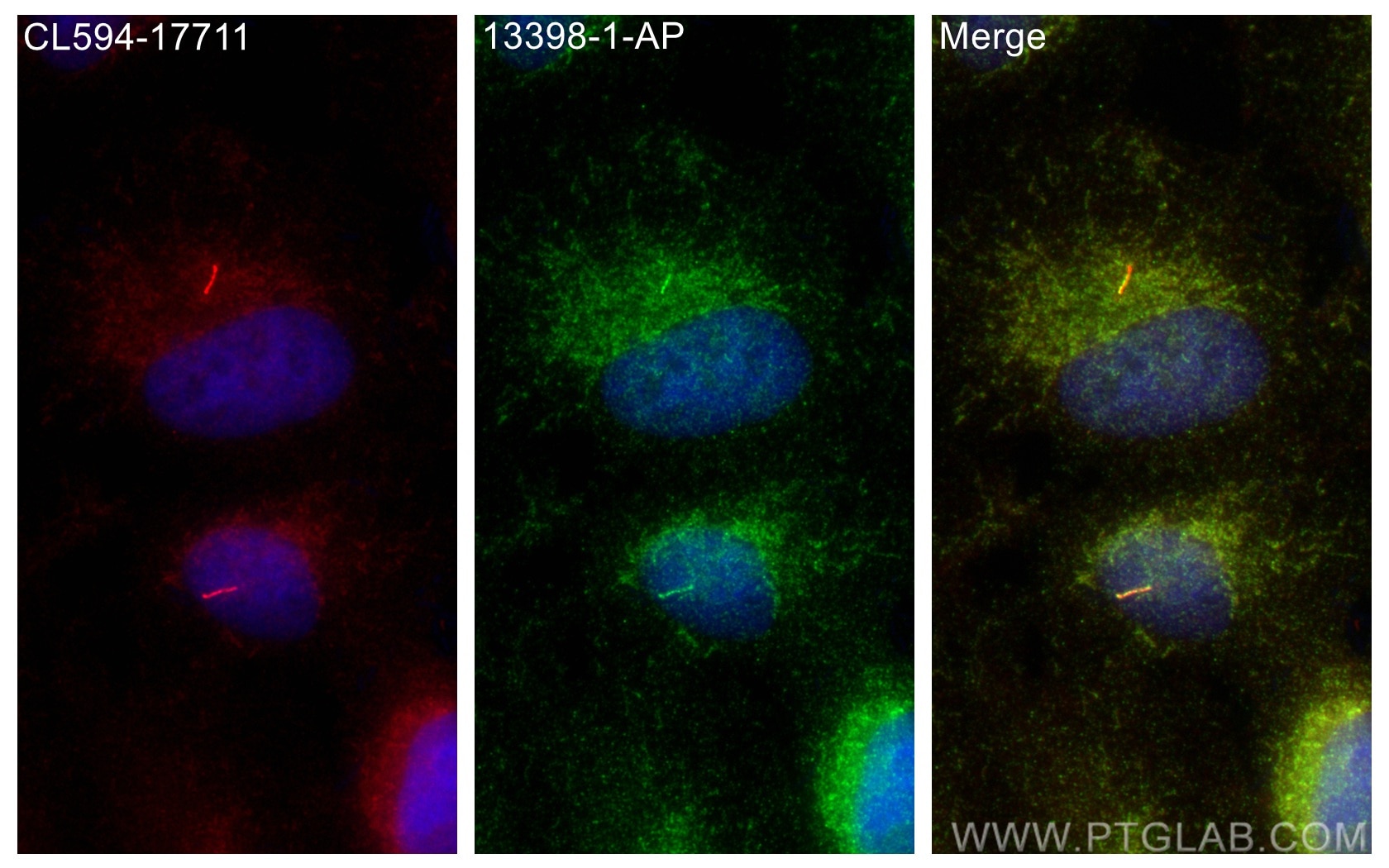 Immunofluorescence (IF) / fluorescent staining of ARPE-19 cells using GPR161 Polyclonal antibody (13398-1-AP)