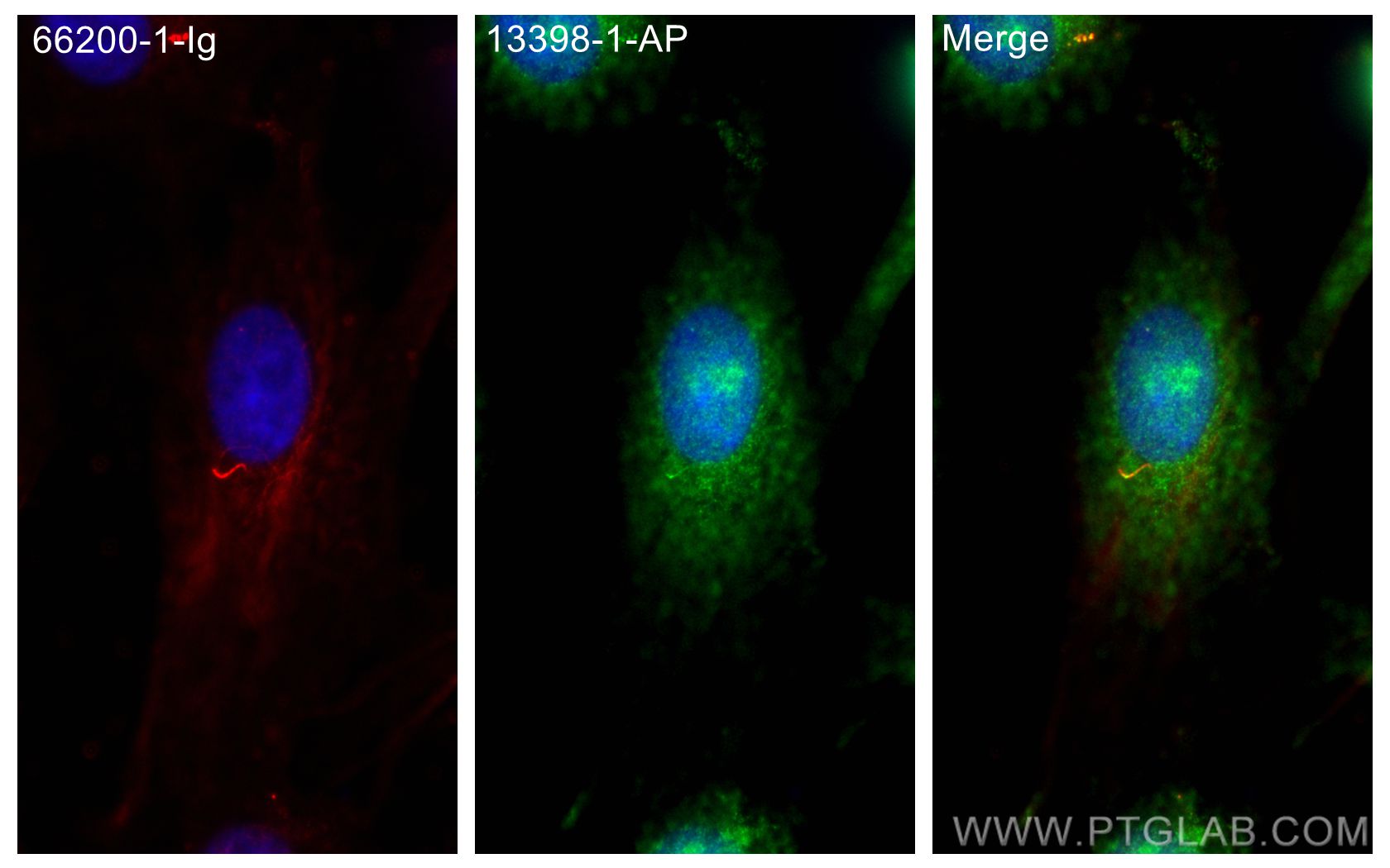 IF Staining of MDCK using 13398-1-AP