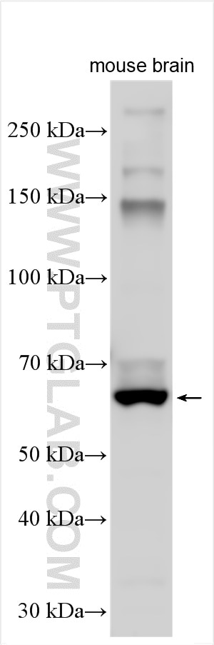 Western Blot (WB) analysis of various lysates using GPR161 Polyclonal antibody (13398-1-AP)