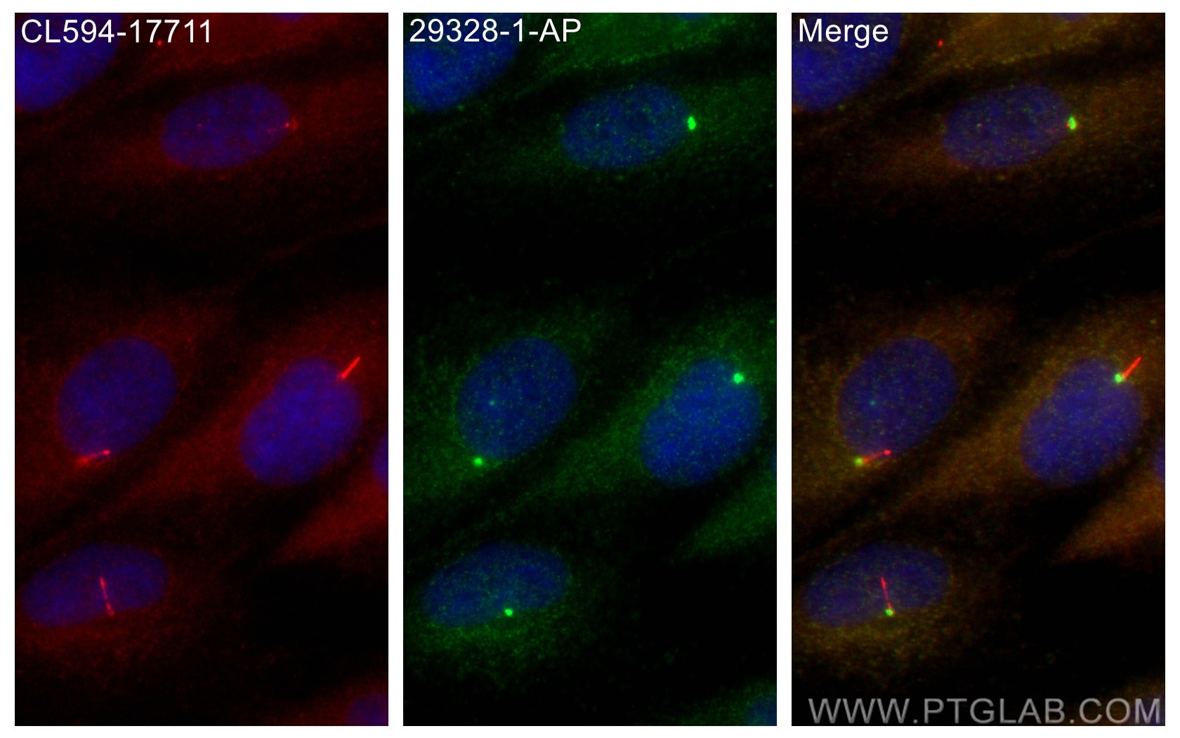 Immunofluorescence (IF) / fluorescent staining of ARPE-19 cells using GPR161 Polyclonal antibody (29328-1-AP)