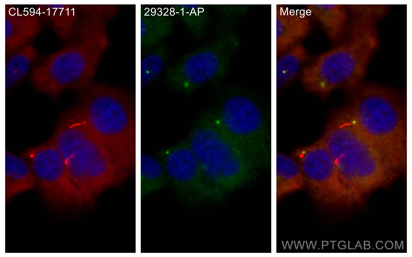 Immunofluorescence (IF) / fluorescent staining of hTERT-RPE1 cells using GPR161 Polyclonal antibody (29328-1-AP)