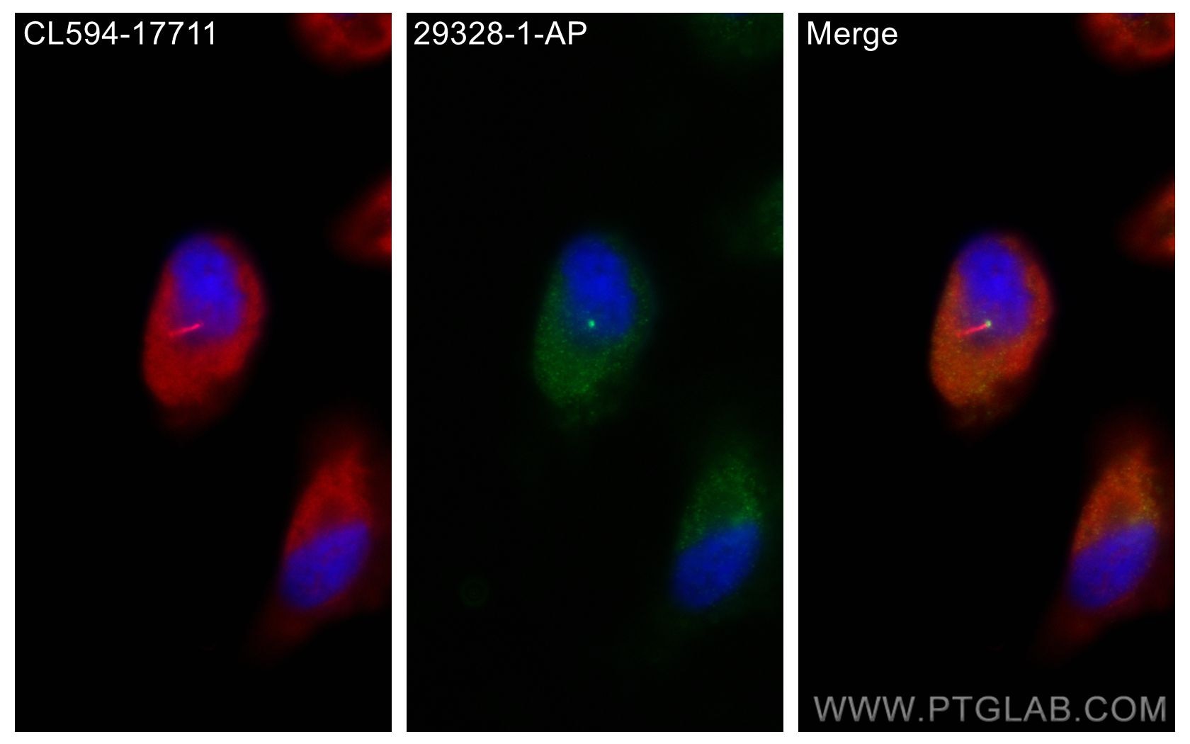 Immunofluorescence (IF) / fluorescent staining of ARPE-19 cells using GPR161 Polyclonal antibody (29328-1-AP)