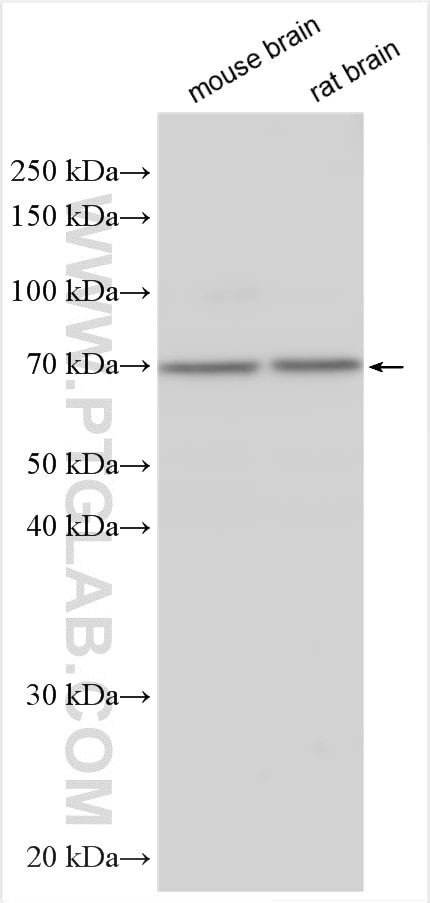 Western Blot (WB) analysis of various lysates using GPR161 Polyclonal antibody (29328-1-AP)