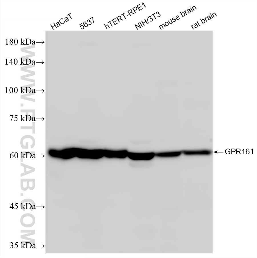 WB analysis using 83557-6-RR (same clone as 83557-6-PBS) Western Blot (WB) analysis of various lysates using GPR161 Recombinant monoclonal antibody (83557-6-RR)