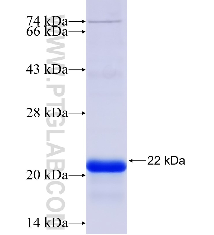 GPR161 fusion protein Ag31023 SDS-PAGE GPR161 fusion protein Ag31023 SDS-PAGE