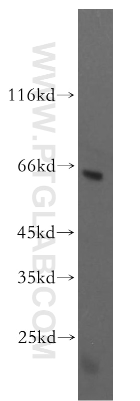 Western Blot (WB) analysis of human brain tissue using GPR162 Polyclonal antibody (15254-1-AP)