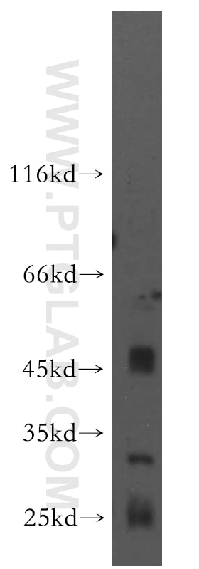 Western Blot (WB) analysis of human brain tissue using GPR162 Polyclonal antibody (15254-1-AP)