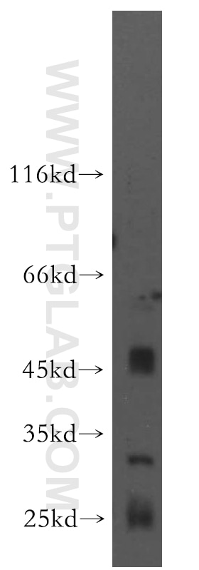 WB analysis of human brain using 15254-1-AP