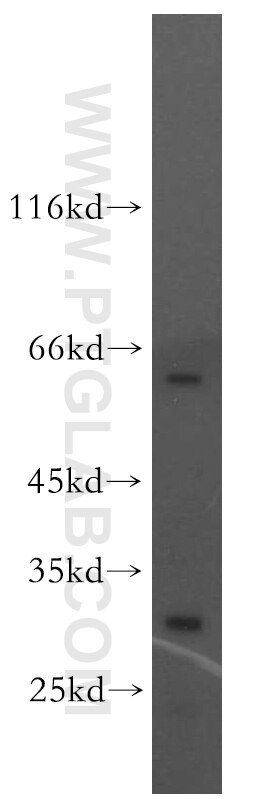 Western Blot (WB) analysis of HeLa cells using GPR162 Polyclonal antibody (15254-1-AP)