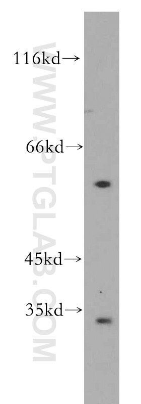 Western Blot (WB) analysis of SH-SY5Y cells using GPR162 Polyclonal antibody (15254-1-AP)