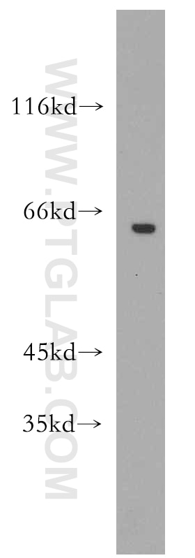Western Blot (WB) analysis of Y79 cells using GPR162 Polyclonal antibody (15254-1-AP)