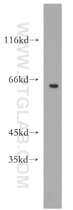 Western Blot (WB) analysis of Y79 cells using GPR162 Polyclonal antibody (15254-1-AP)
