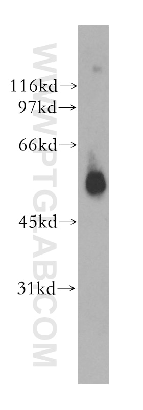 Western Blot (WB) analysis of human plasma using GPR17 Polyclonal antibody (13416-1-AP)