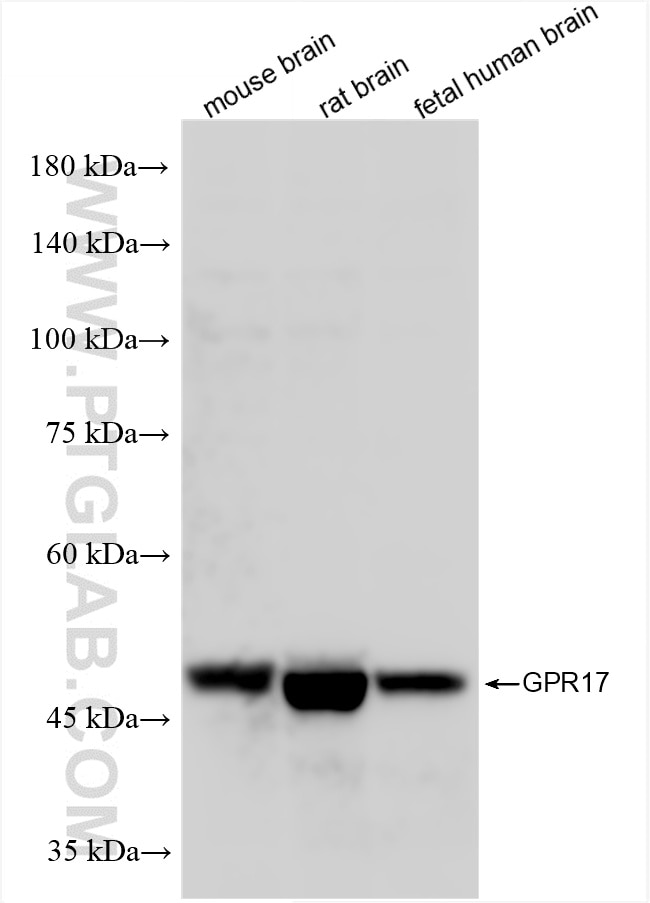 GPR17