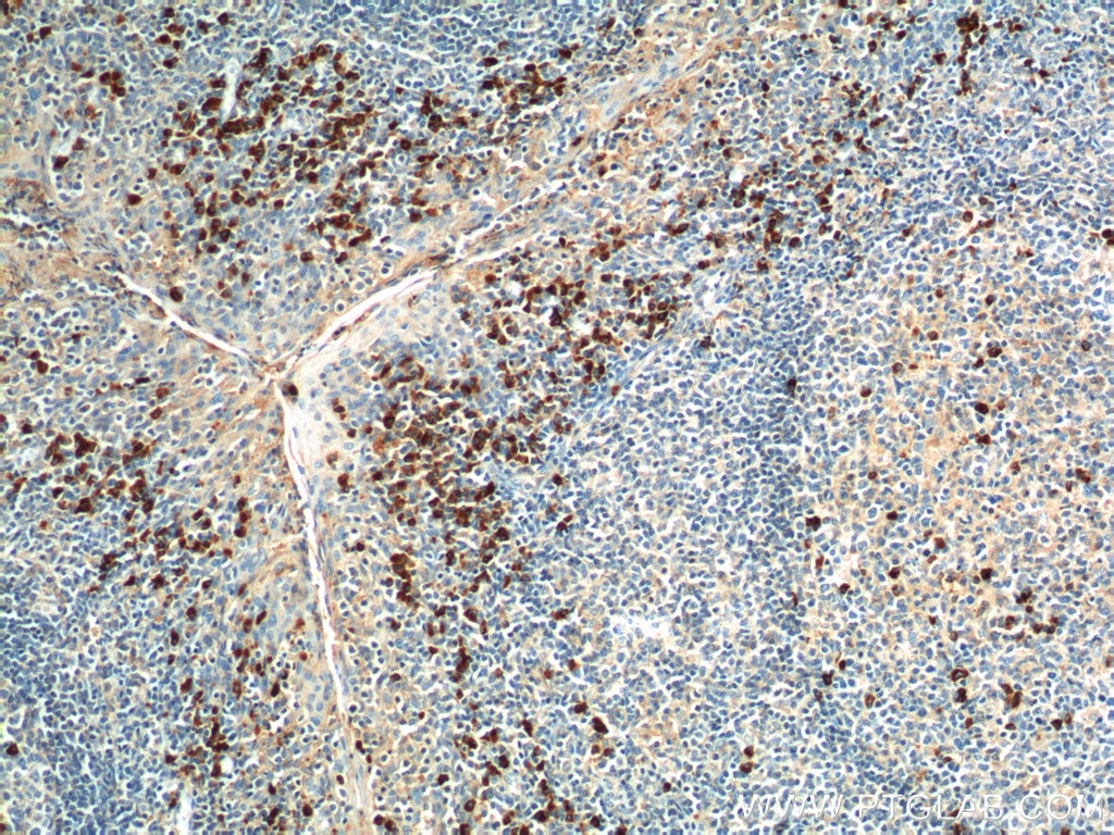 Immunohistochemistry (IHC) staining of human tonsillitis tissue using GPR171 Polyclonal antibody (20307-1-AP)