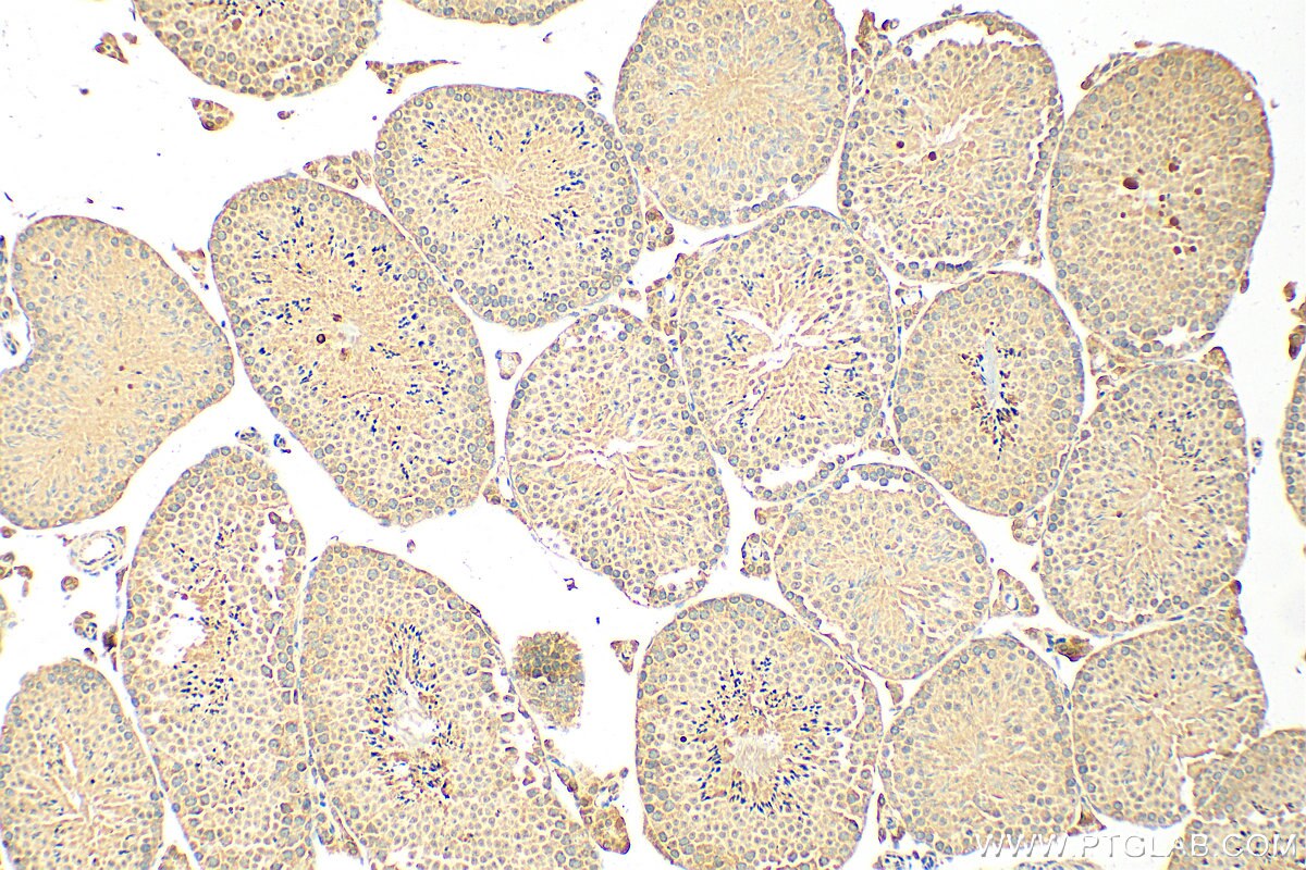 IHC staining of mouse testis using 20791-1-AP (same clone as 20791-1-PBS) Immunohistochemistry (IHC) staining of mouse testis tissue using GPR172B Polyclonal antibody (20791-1-AP)