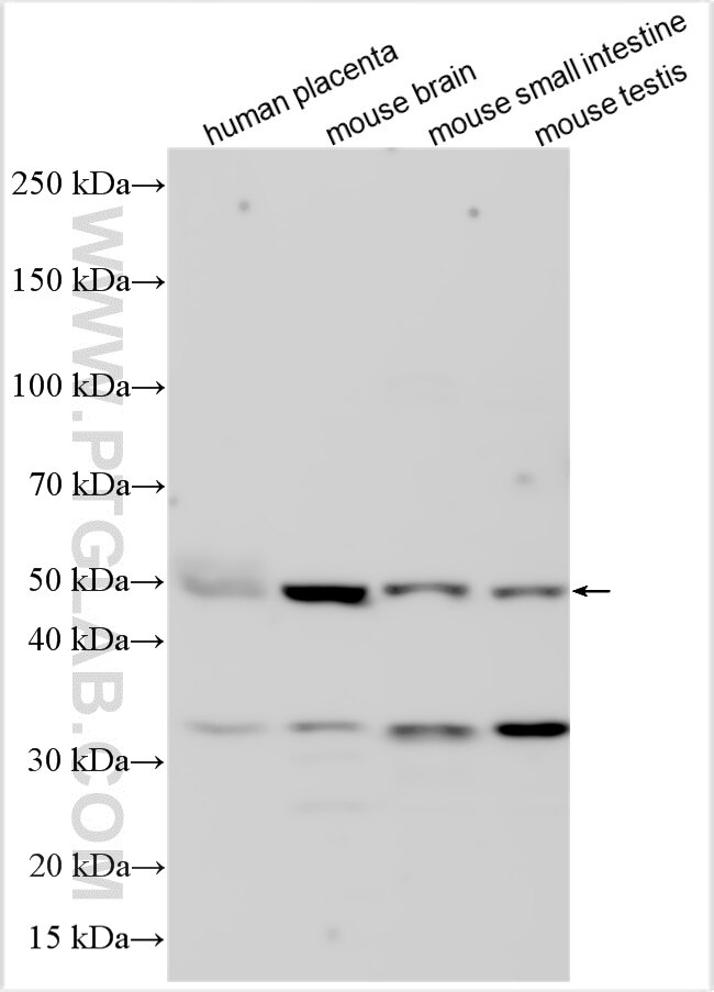 Western Blot (WB) analysis of various lysates using GPR172B Polyclonal antibody (20791-1-AP)