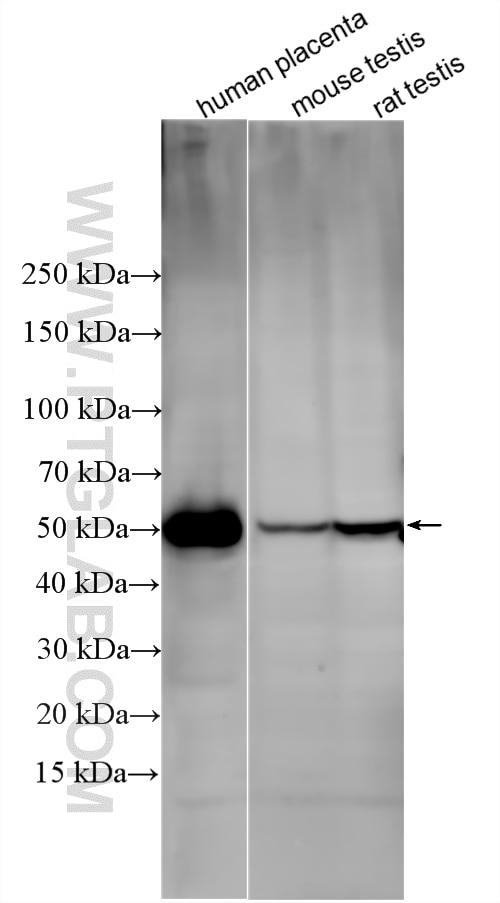 Western Blot (WB) analysis of various lysates using GPR172B Polyclonal antibody (20791-1-AP)