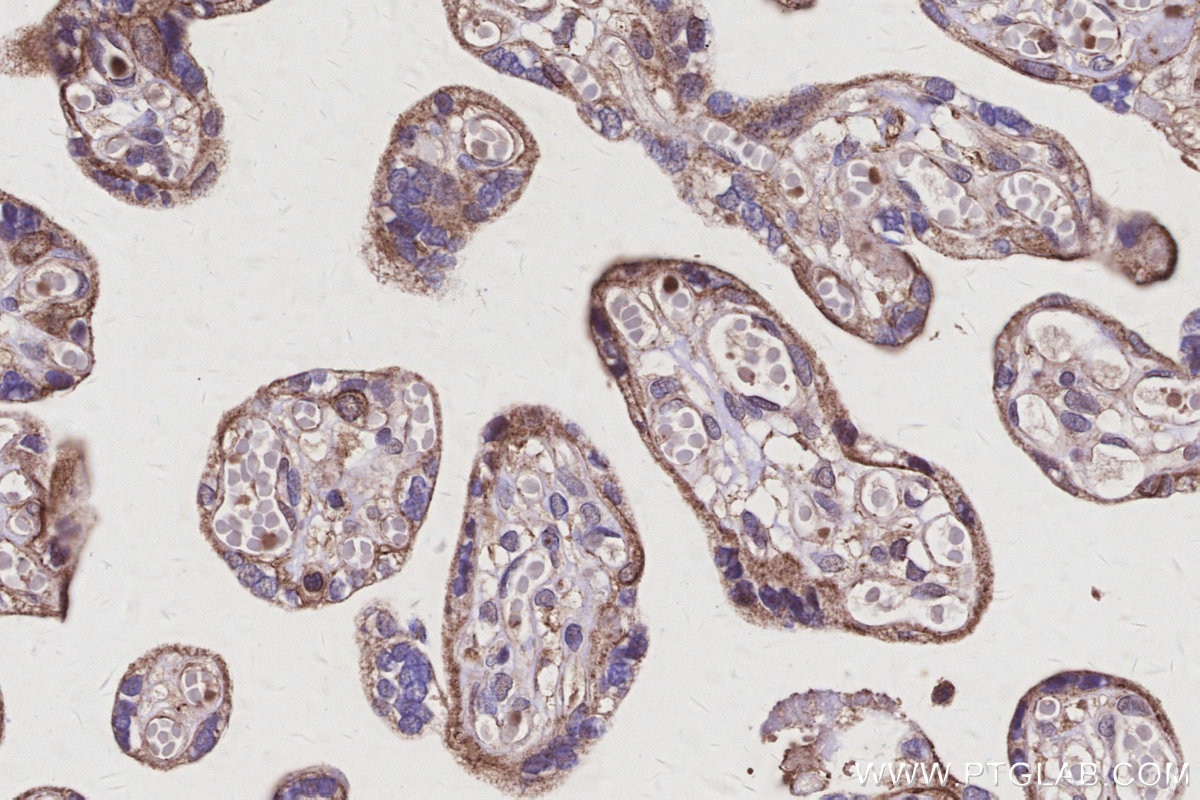 IHC staining of human placenta using 33499-1-AP Immunohistochemistry (IHC) staining of human placenta tissue using GPR175 Polyclonal antibody (33499-1-AP)