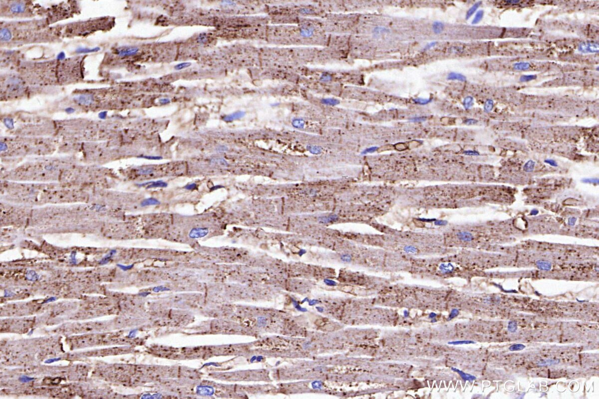 IHC staining of human heart using 33499-1-AP Immunohistochemistry (IHC) staining of human heart tissue using GPR175 Polyclonal antibody (33499-1-AP)
