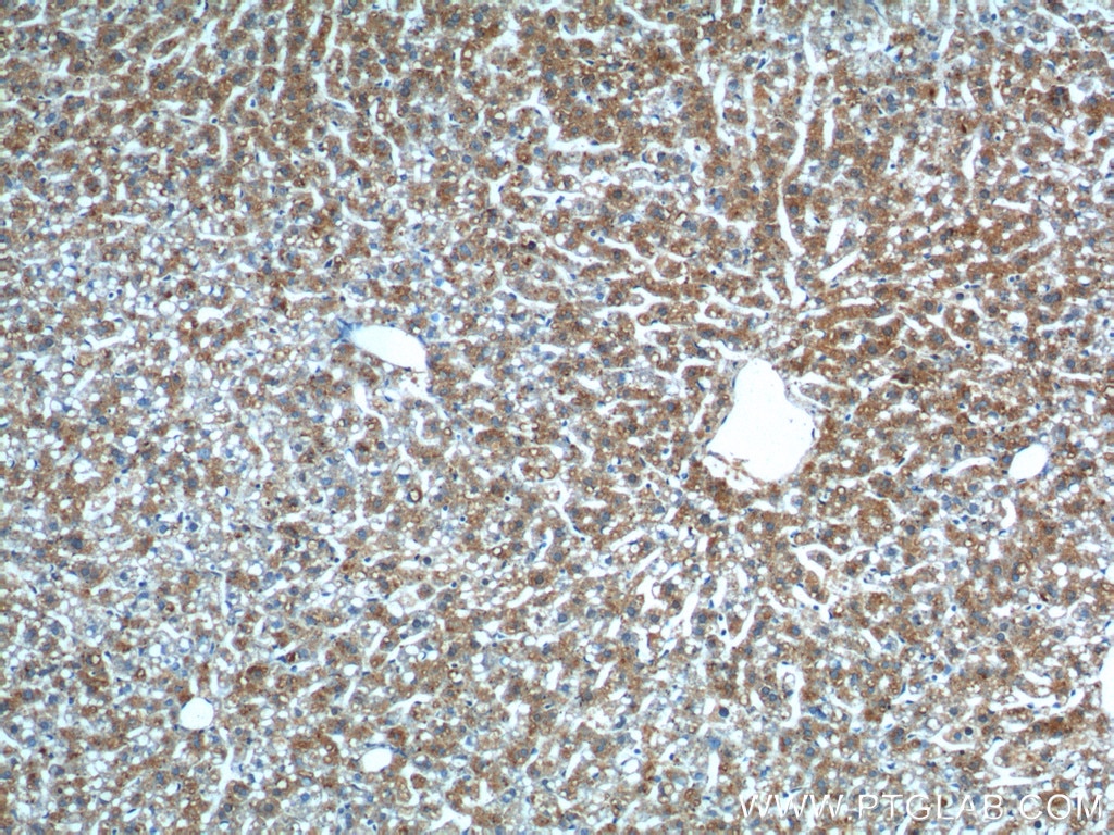 Immunohistochemistry (IHC) staining of mouse liver tissue using GPR177 Polyclonal antibody (17950-1-AP)