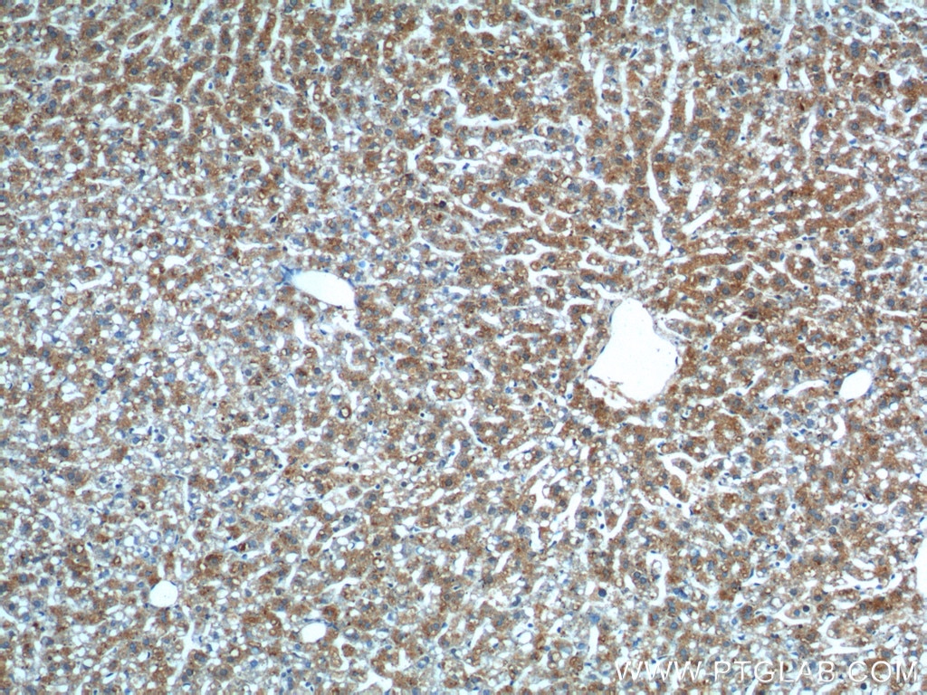 IHC staining of mouse liver using 17950-1-AP