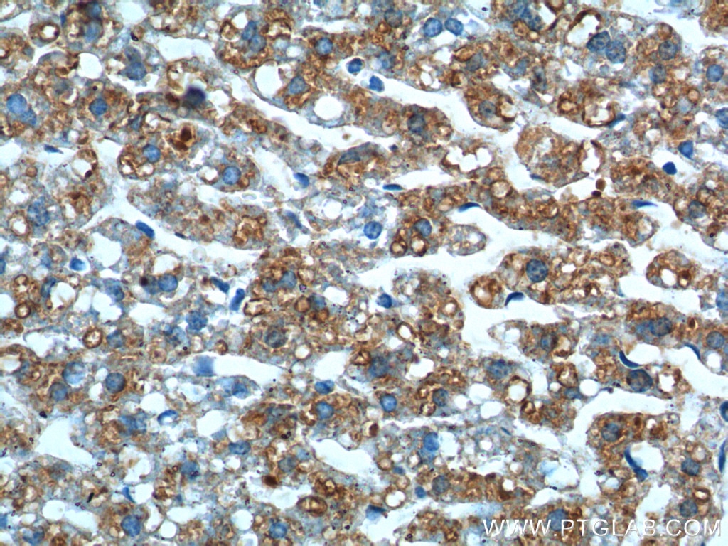 IHC staining of mouse liver using 17950-1-AP