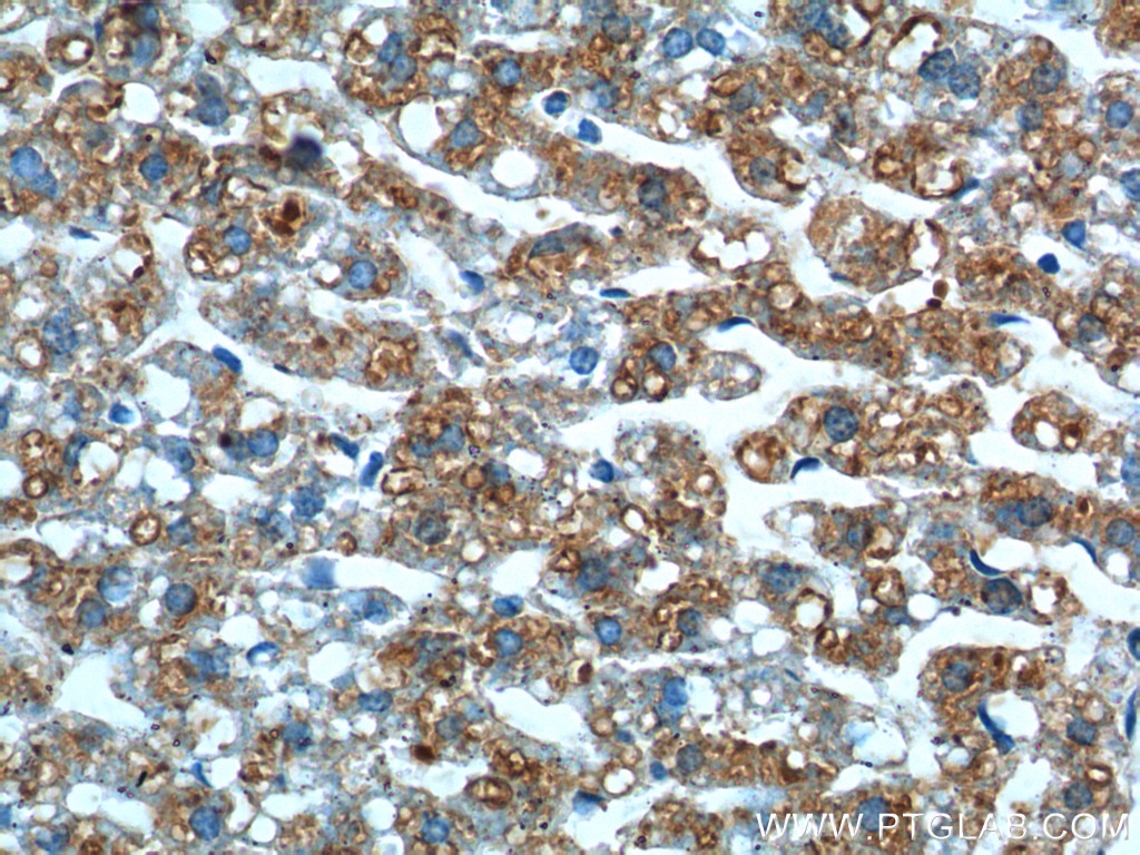 Immunohistochemistry (IHC) staining of mouse liver tissue using GPR177 Polyclonal antibody (17950-1-AP)