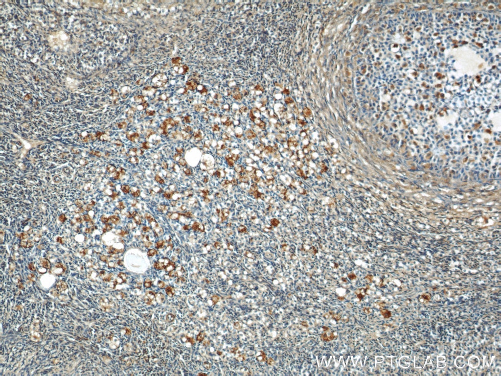 Immunohistochemistry (IHC) staining of human ovary tissue using GPR177 Polyclonal antibody (17950-1-AP)